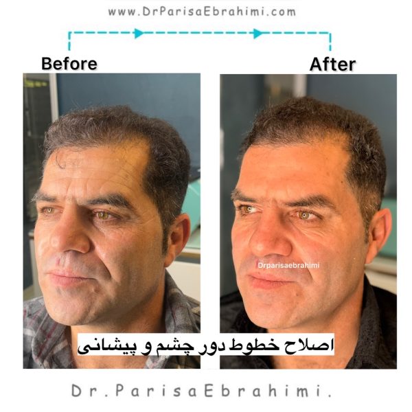 Photo output 600x600